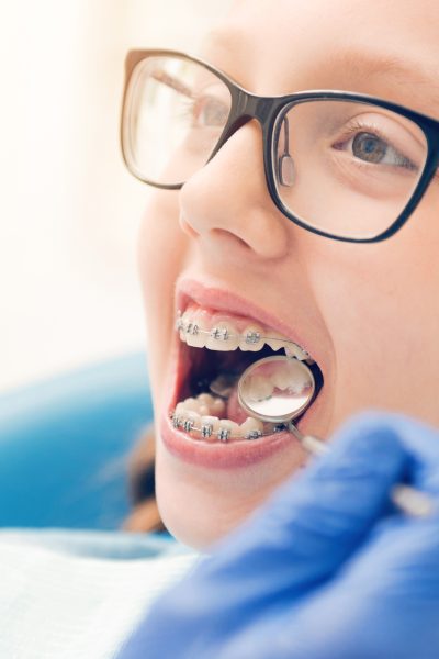 There is nothing to be afraid of. Scaled up shot of a child patient with braces opening her mouth while sitting on a chair and waiting for a dental professional to examine her teeth